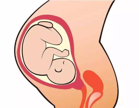 子宫内膜炎症受孕差考虑试管婴儿就可以生育吗