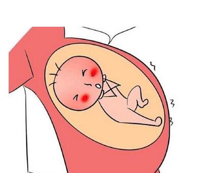 久备不孕黄体不足试管婴儿移植会导致生化吗